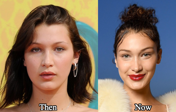 Bella Hadid On Nose Job Bella Hadid On Nose Job