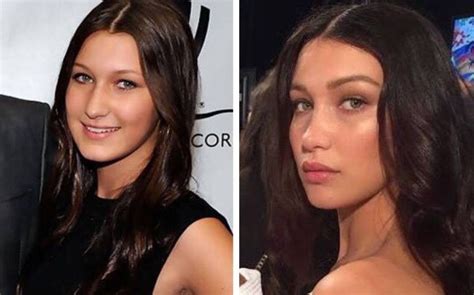 Bella Hadid Plastic Surgery And Modeling Lip Implants Nose Job Nose Bella Hadid Plastic Surgery And Modeling Lip Implants Nose Job Nose