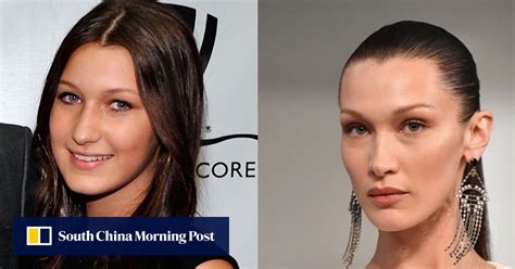 Bella Hadid S Nose Job At 14 Kylie Jenner S Lip Fillers At 15 How Bella Hadid S Nose Job At 14 Kylie Jenner S Lip Fillers At 15 How