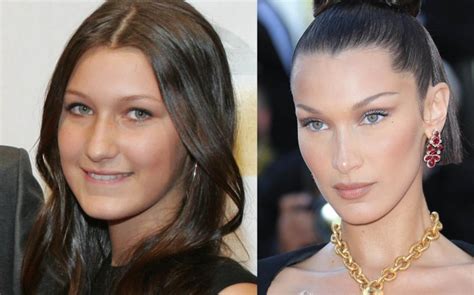 Bella Hadid Talks Nose Job Regret Fashion Industry Pressure In Vogue Bella Hadid Talks Nose Job Regret Fashion Industry Pressure In Vogue