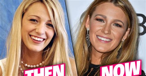 Blake Lively S Nose Job Rumors Secret High School Photos Uncovered Blake Lively S Nose Job Rumors Secret High School Photos Uncovered