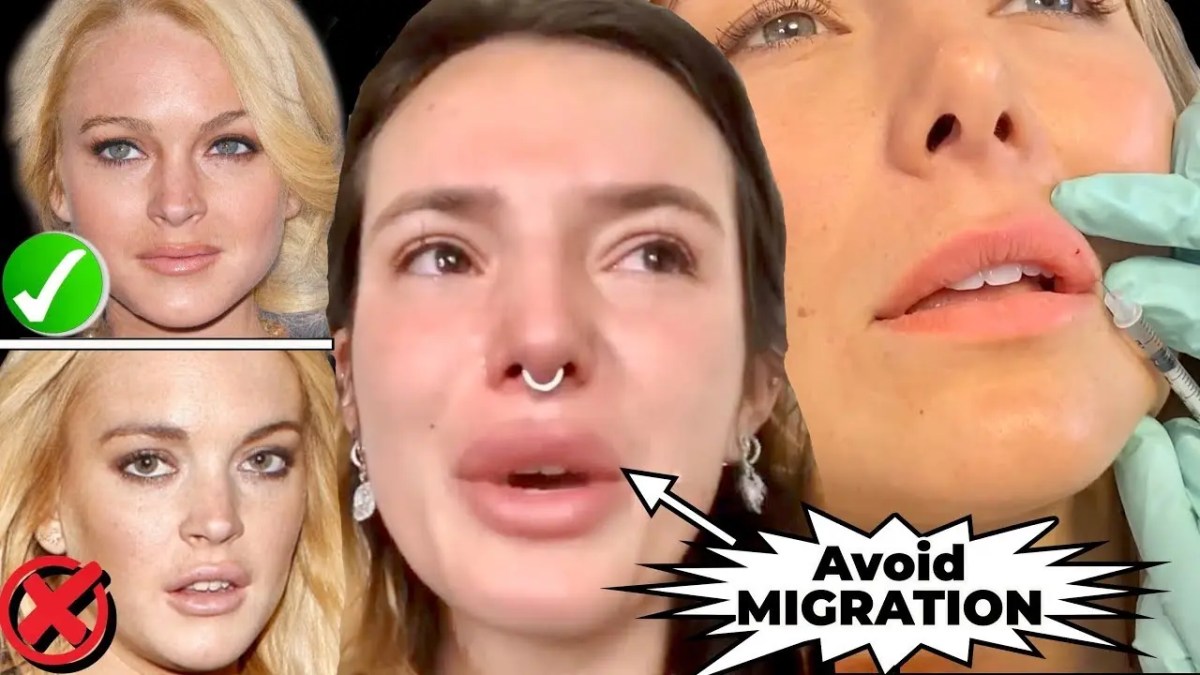 How Much Is A Lip Job